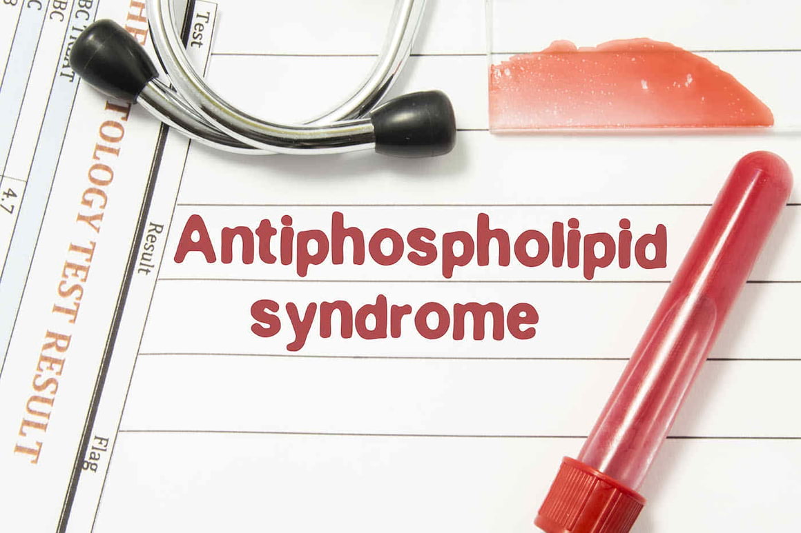 Sindromul antifosfolipidic: cauze, simptome, tratament